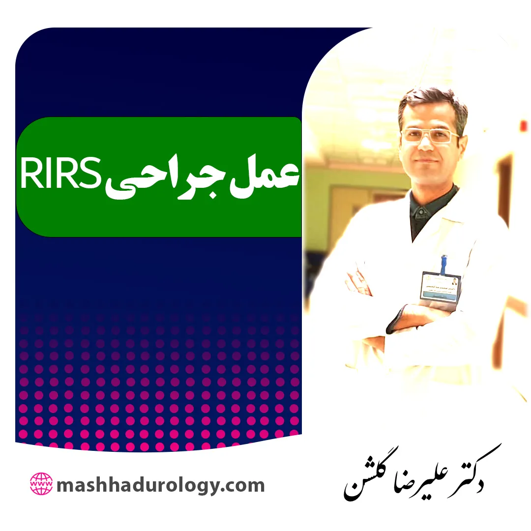  عمل RIRS چیست و چه سنگ هایی را از بین می برد؟